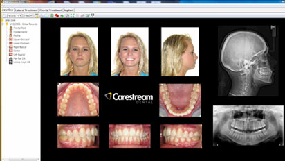 CS Orthodontic Imaging Software
